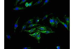 Immunofluorescence staining of Hela cells with ABIN7163135 at 1:200, counter-stained with DAPI. (Sphingomyelin Synthase 2 抗体  (AA 1-79))