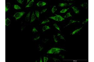 Immunofluorescence of purified MaxPab antibody to OXA1L on HeLa cell. (OXA1L 抗体  (AA 1-435))