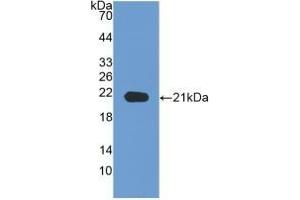 Detection of Recombinant NRP1, Human using Monoclonal Antibody to Neuropilin 1 (NRP1) (Neuropilin 1 抗体  (AA 646-814))