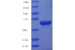 SDS-PAGE (SDS) image for HD Domain Containing 3 (HDDC3) (AA 2-140) protein (His-SUMO Tag) (ABIN4974300) (HDDC3 Protein (AA 2-140) (His-SUMO Tag))