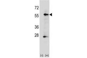 Western blot analysis of placental Alkaline Phosphatase antibody and 293 cell lysate (2 ug/lane) either nontransfected (Lane 1) or transiently transfected (2) with the ALPP gene. (Alkaline Phosphatase 抗体  (AA 56-83))