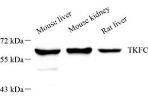 Western blot analysis of DAK (ABIN7073737),at dilution of 1: 1000,Lane 1: Mouse liver tissue lysate,Lane 2: Mouse kidney tissue lysate,Lane 3: Rat liver tissue lysate (DAK 抗体)