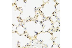 Immunohistochemistry of paraffin-embedded rat lung using SUZ12 antibody (ABIN5975314) at dilution of 1/100 (40x lens). (SUZ12 抗体)