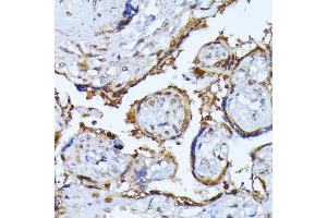 Immunohistochemistry of paraffin-embedded human placenta using RPS27A antibody (ABIN3022728, ABIN3022729, ABIN1513489, ABIN1514633 and ABIN6219198) at dilution of 1:100 (40x lens). (RPS27A 抗体  (AA 1-156))