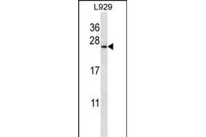 Western Blotting (WB) image for anti-Coatomer Protein Complex, Subunit zeta 1 (COPZ1) (AA 24-53), (N-Term) antibody (ABIN657051)