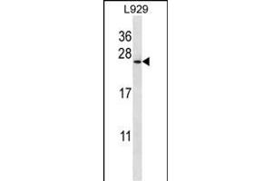 COPZ1 Antibody (N-term) (ABIN657051 and ABIN2846218) western blot analysis in  cell line lysates (35 μg/lane). (COPZ1 抗体  (N-Term))