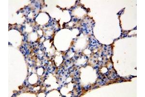 IHC-P: Aquaporin 5 antibody testing of rat lung tissue lysate (Aquaporin 5 抗体  (C-Term))
