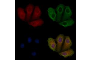 ABIN6259201 and ABIN6275855 staining Hela cells by IF/ICC. (STK33 抗体  (N-Term))