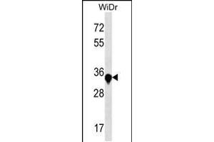 Western blot analysis in WiDr cell line lysates (35ug/lane). (AMMECR1 抗体  (C-Term))