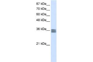 WB Suggested Anti-CACNG4 Antibody Titration:  0. (CACNG4 抗体  (N-Term))