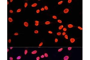 Immunofluorescence analysis of C6 cells using MonoMethyl-Histone H3-K9 Polyclonal Antibody at dilution of 1:100.