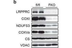 Western Blotting (WB) image for anti-Citrate Synthase (CS) antibody (ABIN2856769)