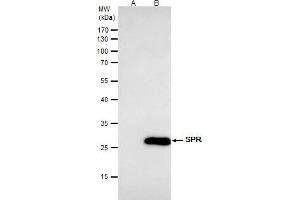 IP Image SPR antibody [N2C3] immunoprecipitates SPR protein in IP experiments. (SPR 抗体)
