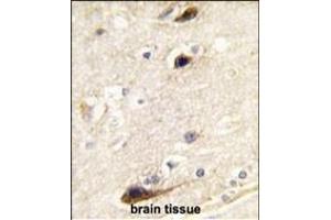 Immunohistochemistry (Paraffin-embedded Sections) (IHC (p)) image for anti-Phosphatidylinositol-4-Phosphate 5-Kinase, Type I, beta (PIP5K1B) (AA 1-30), (N-Term) antibody (ABIN392594)