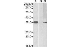 HEK293 lysate (10µg protein in RIPA buffer) overexpressing Human MYF6 with MYC tag probed with AP21502PU-N (0. (MYF6 抗体  (Internal Region))