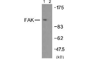 Western blot analysis of extracts from HeLa cells using FAK (Ab-925) antibody (#B7083).