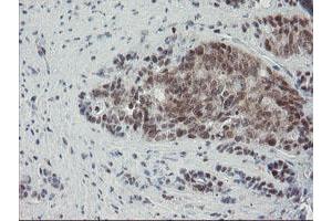 Image no. 2 for anti-Negative Regulator of Ubiquitin-Like Proteins 1 (NUB1) (AA 1-326) antibody (ABIN1490743) (NUB1 抗体  (AA 1-326))