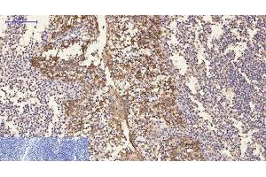 Immunohistochemistry of paraffin-embedded Human tonsil tissue using CK-16 Monoclonal Antibody at dilution of 1:200. (KRT16 抗体)