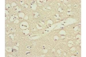 Immunohistochemistry of paraffin-embedded human brain tissue using ABIN7157675 at dilution of 1:100 (DSN1 抗体  (AA 1-356))