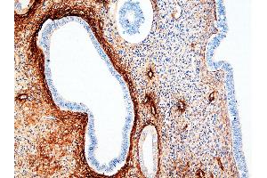 Immunohistochemistry (IHC) image for anti-Tenascin C (TNC) antibody (ABIN108415) (TNC 抗体)