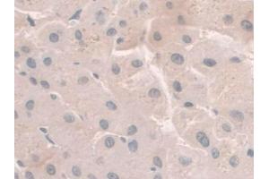IHC-P analysis of Human Liver Tissue, with DAB staining. (HFE2 抗体  (AA 234-416))