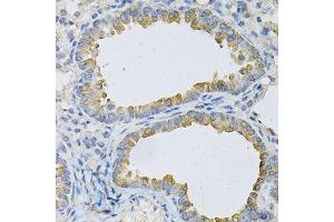 Immunohistochemistry of paraffin-embedded mouse lung using AP2B1 Antibody. (AP2B1 抗体  (AA 752-951))