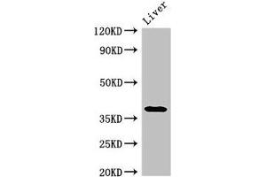 Western Blot Positive WB detected in: Rat liver tissue All lanes: PRKAG1 antibody at 3 μg/mL Secondary Goat polyclonal to rabbit IgG at 1/50000 dilution Predicted band size: 38, 35, 39 kDa Observed band size: 38 kDa (PRKAG1 抗体  (AA 1-331))