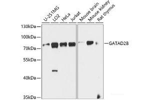 Western blot analysis of extracts of various cell lines using GATAD2B Polyclonal Antibody at dilution of 1:1000. (GATAD2B 抗体)
