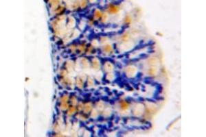 Used in DAB staining on fromalin fixed paraffin-embedded Intestine tissue (HAUS7 抗体  (AA 1-227))