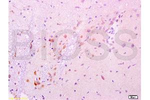 Formalin-fixed and paraffin embedded rat brain labeled with Anti-GDNF Polyclonal Antibody, Unconjugated (ABIN736536) at 1:200 followed by conjugation to the secondary antibody and DAB staining. (GDNF 抗体  (AA 121-211))