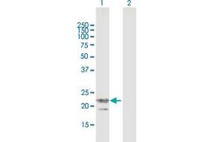 Western Blot analysis of TRGV3 expression in transfected 293T cell line by TRGV3 MaxPab polyclonal antibody. (TRGV3 抗体  (AA 1-200))