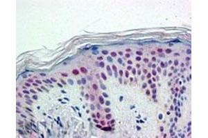PTBP1 polyclonal antibody (Cat # PAB6476, 5 ug/mL) staining of paraffin embedded Human Skin. (PTBP1 抗体)