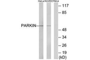 Western blot analysis of extracts from HeLa/HuvEc cells, using Parkin (Ab-131) Antibody. (Parkin 抗体  (AA 101-150))