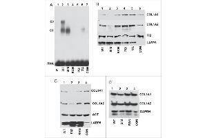 Western Blotting (WB) image for anti-Collagen, Type I (COL1) antibody (ABIN5596819)