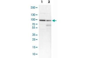 Western Blot analysis of Lane 1: NIH-3T3 cell lysate (mouse embryonic fibroblast cells) and Lane 2: NBT-II cell lysate (Wistar rat bladder tumor cells) with CCNT1 polyclonal antibody . (Cyclin T1 抗体)