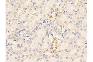 ABIN6265820 and ABIN6268771 at 1/100 staining Rat kidney tissue by IHC-P. (TYK2 抗体  (C-Term))