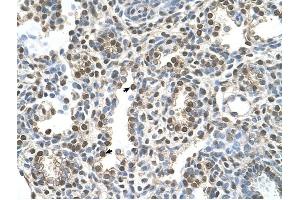 MAGEA8 antibody was used for immunohistochemistry at a concentration of 16. (MAGEA8 抗体  (N-Term))