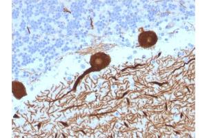 Formalin-fixed, paraffin-embedded human Cerebellum stained with CA8 Mouse Monoclonal Antibody (CPTC-CA8-2).