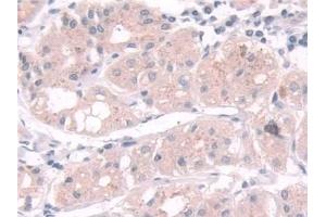 Detection of TPMT in Human Stomach Tissue using Polyclonal Antibody to Thiopurine Methyltransferase (TPMT) (TPMT 抗体  (AA 26-227))