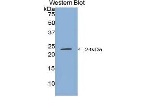 Detection of Recombinant TIMP4, Human using Polyclonal Antibody to Tissue Inhibitors Of Metalloproteinase 4 (TIMP4) (TIMP4 抗体  (AA 32-224))