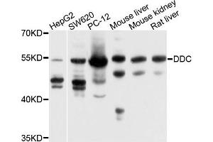 Western blot analysis of extracts of various cells, using DDC antibody. (DDC 抗体)