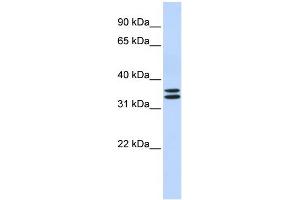 WB Suggested Anti-TAL1 Antibody Titration: 0. (TAL1 抗体  (N-Term))