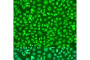 Immunofluorescence analysis of U2OS cells using COQ7 Polyclonal Antibody at dilution of 1:100. (Coq7 抗体)