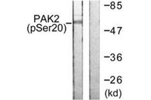 Western blot analysis of extracts from 293 cells treated with Sorbitol 0. (PAK2 抗体  (pSer20))