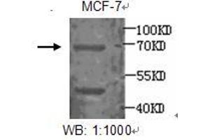 Image no. 1 for anti-Estrogen Receptor 1 (ESR1) antibody (ABIN790861) (Estrogen Receptor alpha 抗体)