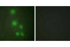 Peptide - +Western blot analysis of extracts from Jurkat cells and COLO205 cells, using ACL6A antibody. (BAF53A 抗体  (Internal Region))