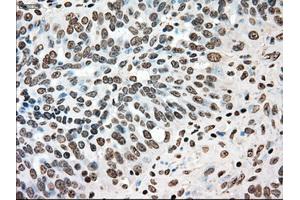 Immunohistochemical staining of paraffin-embedded colon tissue using anti-TYRO3mouse monoclonal antibody. (TYRO3 抗体)