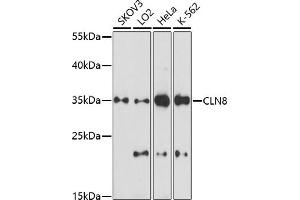 Western blot analysis of extracts of various cell lines, using CLN8 antibody (ABIN7266285) at 1:1000 dilution. (CLN8 抗体)