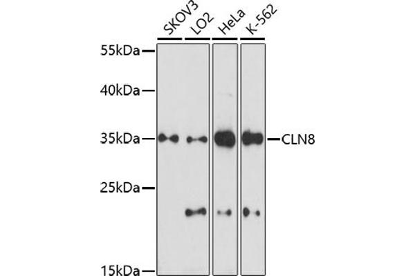 CLN8 抗体