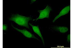 Immunofluorescence of monoclonal antibody to RGS20 on HeLa cell. (RGS20 抗体  (AA 78-176))